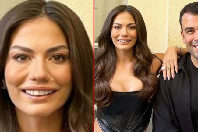 Demet Ozdemir - loše osvetljenje ili loša plastična operacija?!