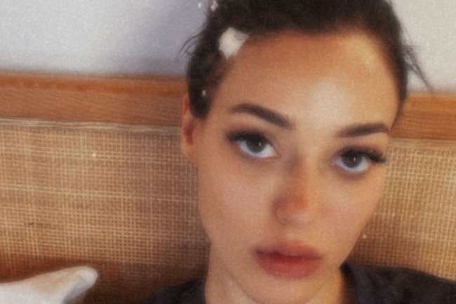 Dilan Cicek Deniz doživela povredu glave na snimanju njene nove serije