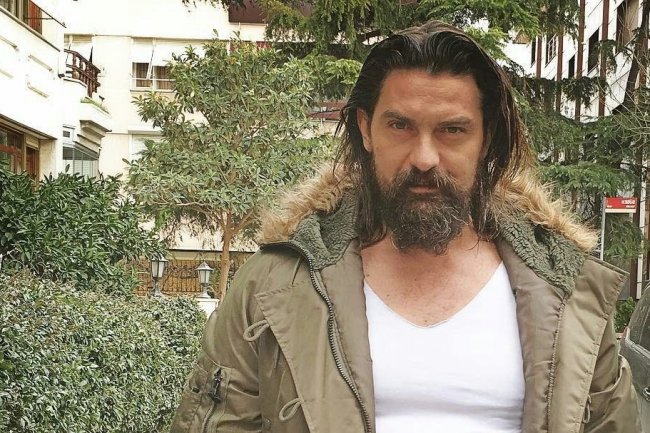 Nurettin Sonmez operisan nakon nezgodne povrede