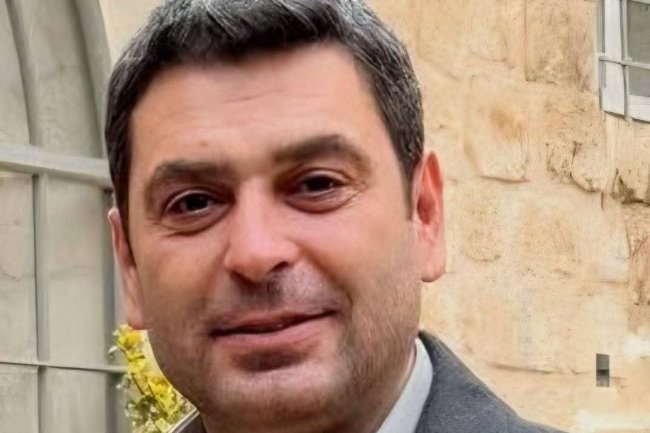 Promene u izgledu Ozana Akbabe izazvale reakcije na društvenim mrežama