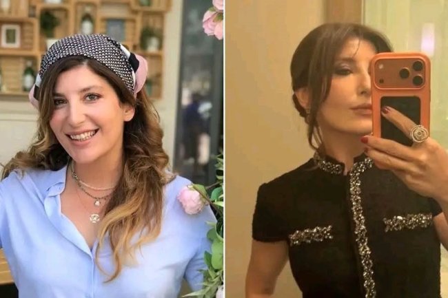 Poznata turska glumica Sebnem Bozoklu smršala 20 kilograma za godinu dana