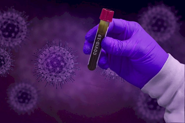 Studija otkriva da anti-parazitski lek može ubiti koronavirus za 48 sati?!